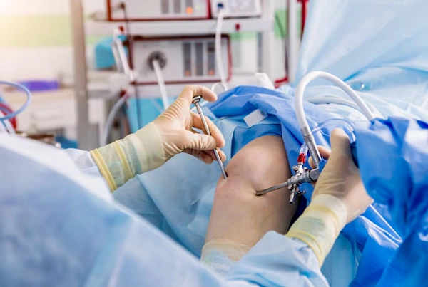 Hip Replacement Sugery
